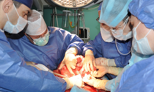 В Ростовском онкоцентре пациентке удалили гигантскую опухоль весом 20 кг
