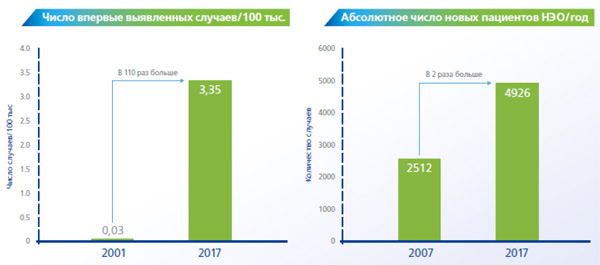 Заболеваемость НЭО в РФ