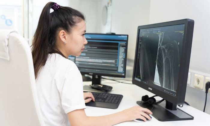 ИИ поможет рентгенологам Москвы диагностировать патологии межпозвонковых дисков