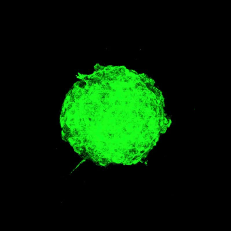 Ученые показали, как бактерии помогают опухоли преодолевать иммунную защиту и метастазировать