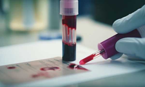 В Сеченовском университете научились оценивать риски семи видов рака по одному образцу крови