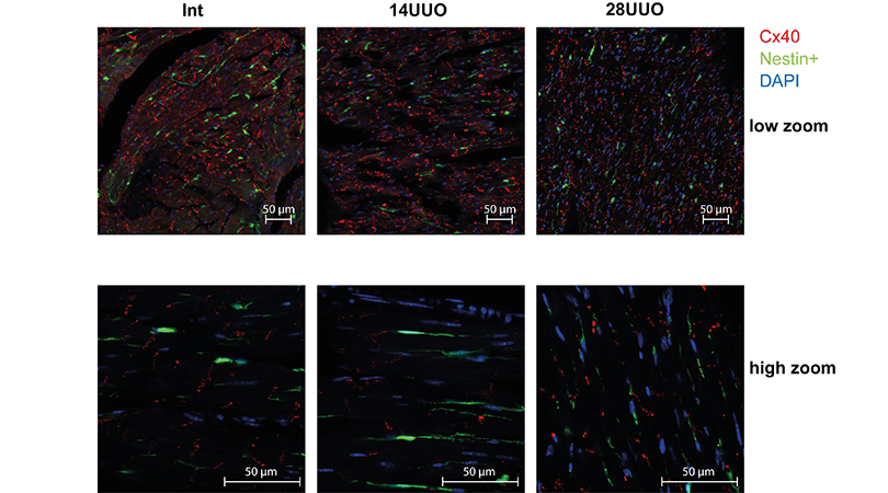 Исследование нестин-позитивных клеток в миокарде может помочь при разработке лекарства для почек и сердца