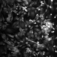 Ученые МФТИ смоделировали аритмию на культуре клеток сердца