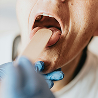 Слюна поможет в ранней диагностике рака