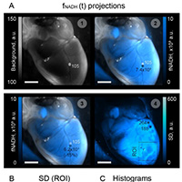 Российские ученые научились видеть скрытые повреждения сердечной ткани в режиме реального времени