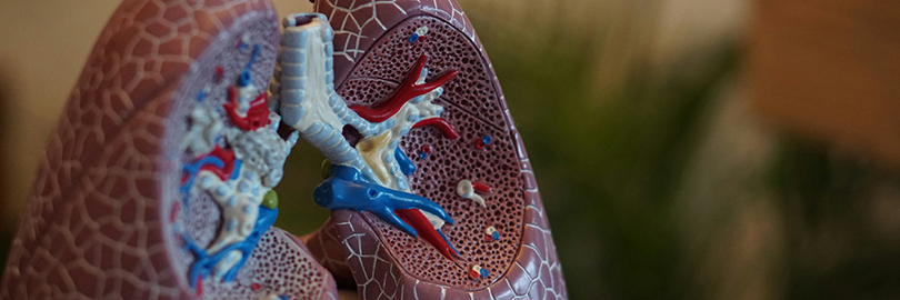 Бронхиальная астма и рака легкого