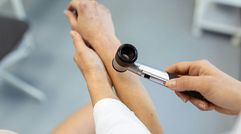 Псориаз связан с 14 видами рака