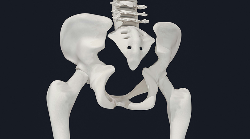 Перелом крестца как осложнение облучения