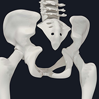 Перелом крестца как осложнение облучения 